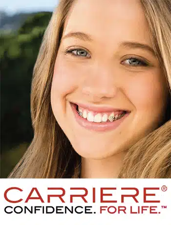 Carriere Motion Appliance