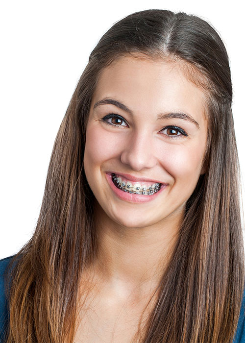 Orthodontists for Teens in Layton